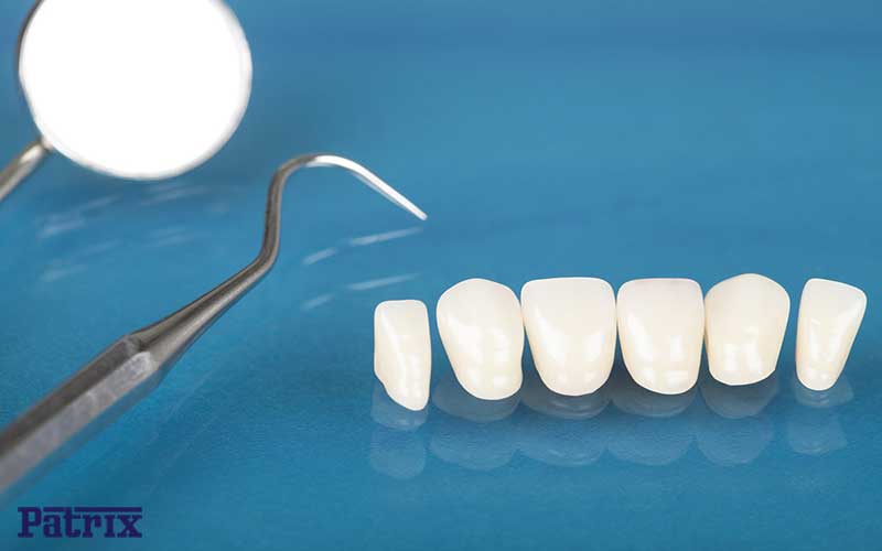 چرا مراقبت‌های بعد از لمینت دندان مهم است؟
