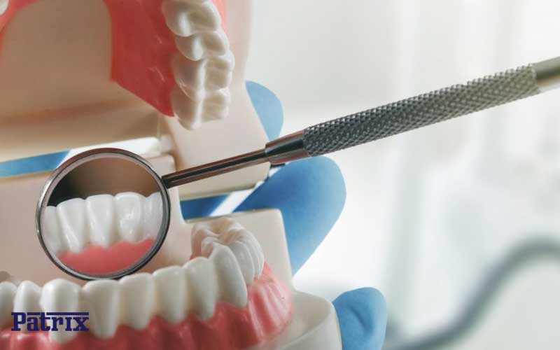 روش های درمان بیماری های دهان و دندان