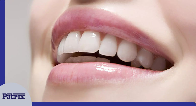 آیا خمیردندان سفیدکننده برای همه مناسب است؟