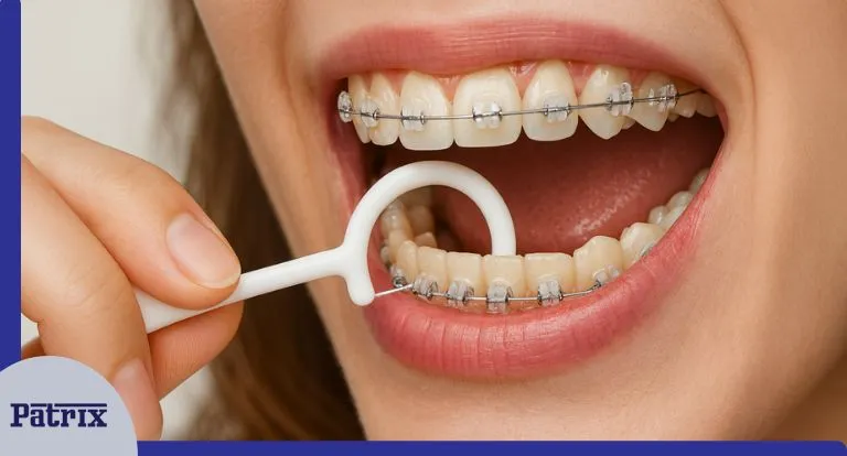 انواع نخ دندان مناسب برای ارتودنسی